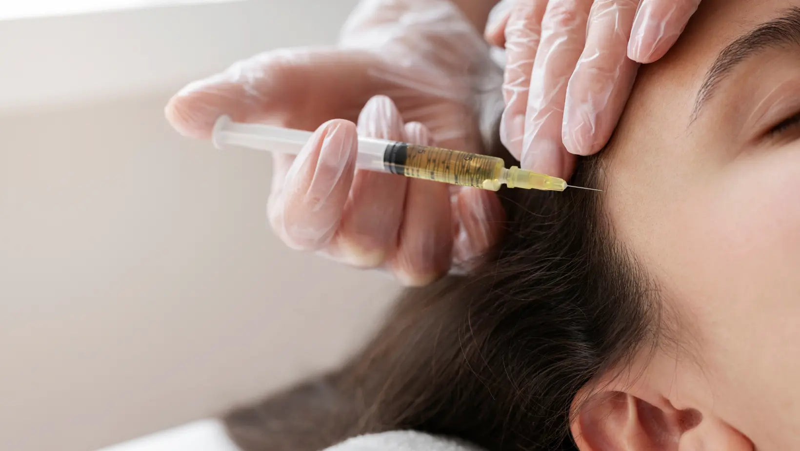 Microneedling with exosomes vs PRP