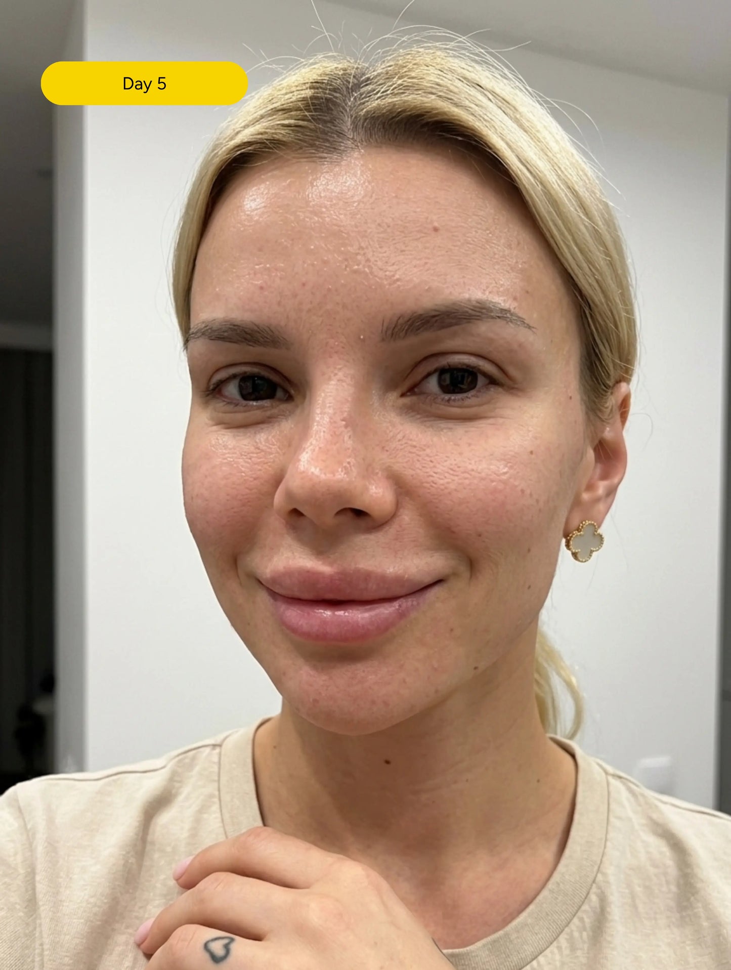 Ceramide Repair Complex