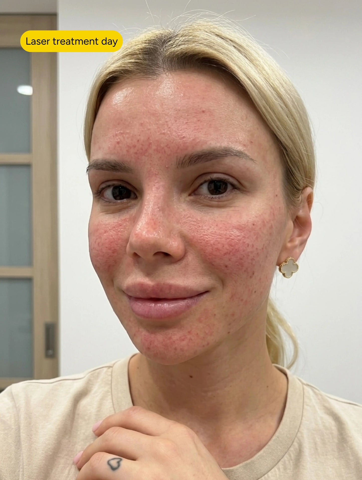 Ceramide Repair Complex