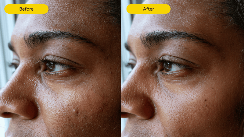 Sensitive skin before and after using exosome serum