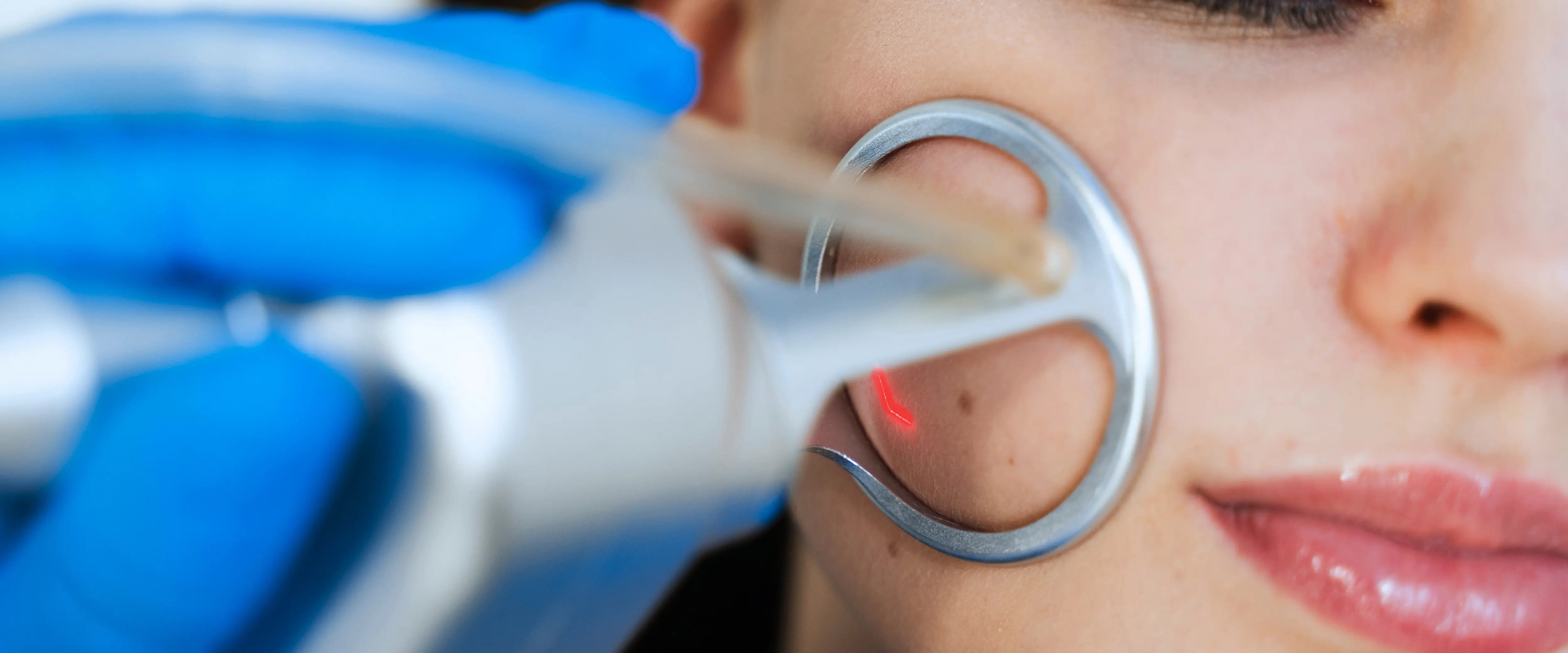 Co2 laser vs microneedling​