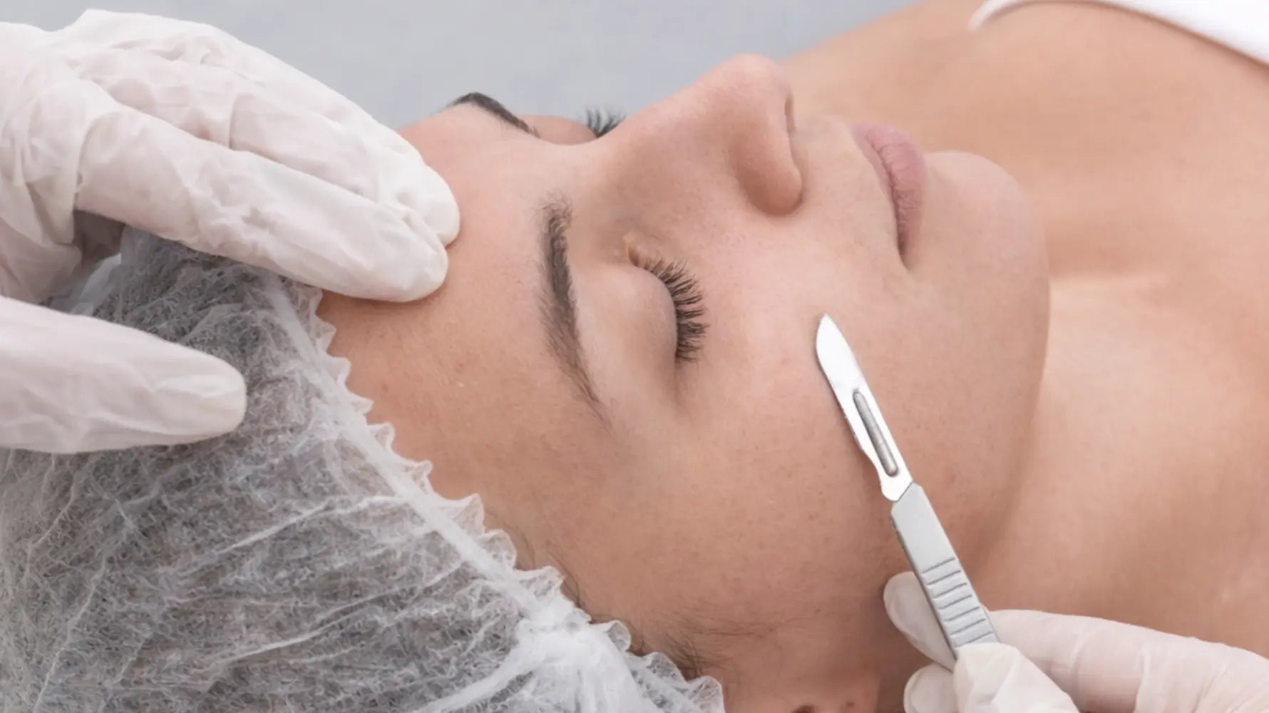 Dermaplaning vs Microneedling