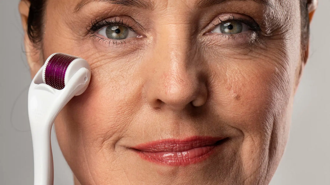 Does At Home Microneedling Work?