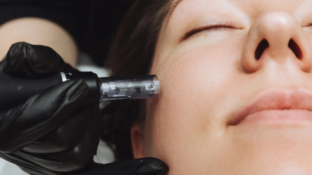 Does Microneedling Tighten Skin?