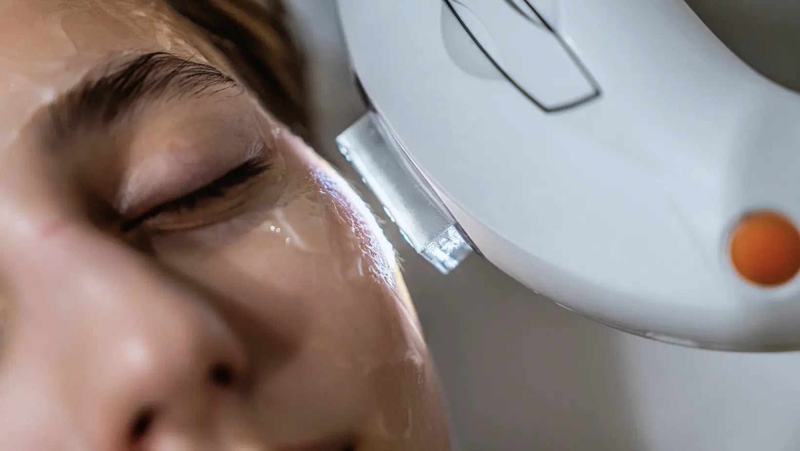 Fraxel Laser Recovery