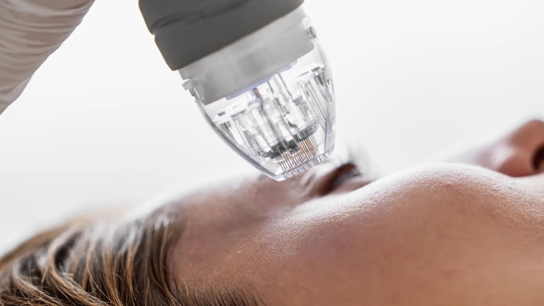 How To Microneedle Face