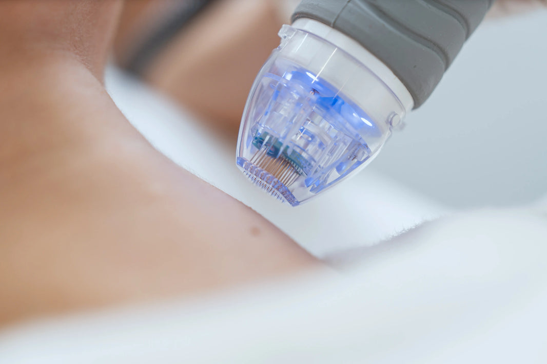 How Often Can You Do Microneedling?
