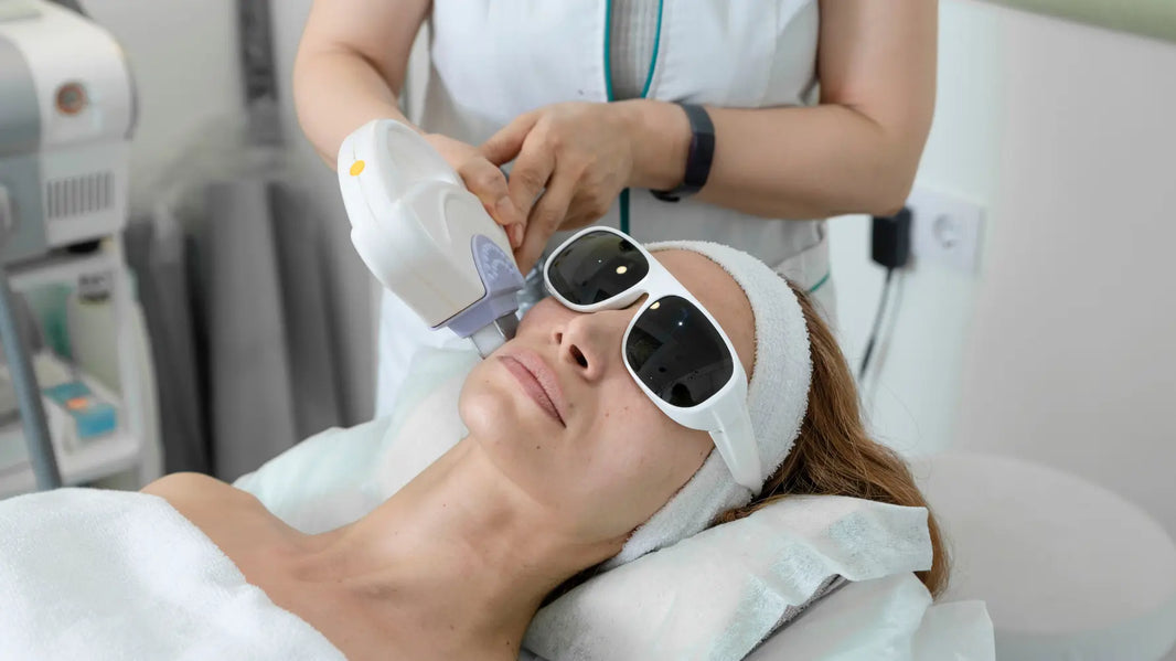 IPL vs microneedling