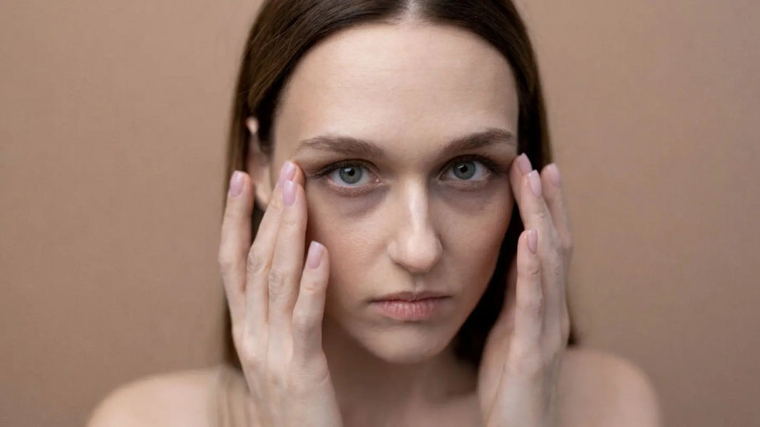 Microneedling For Dark Circles