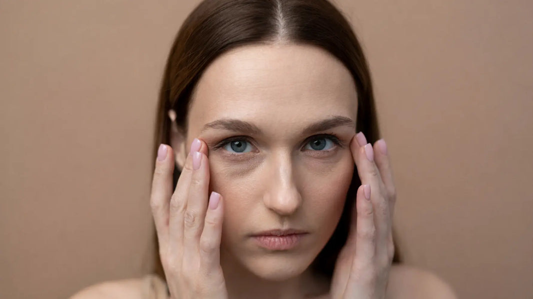 Microneedling for Under Eye Bags