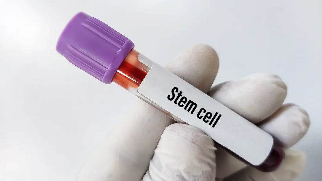 Microneedling with Exosomes