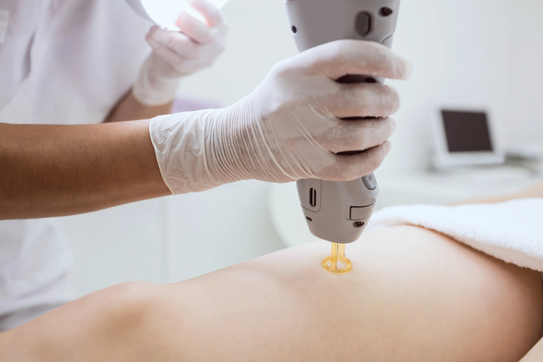 Pico Laser for Hyperpigmentation