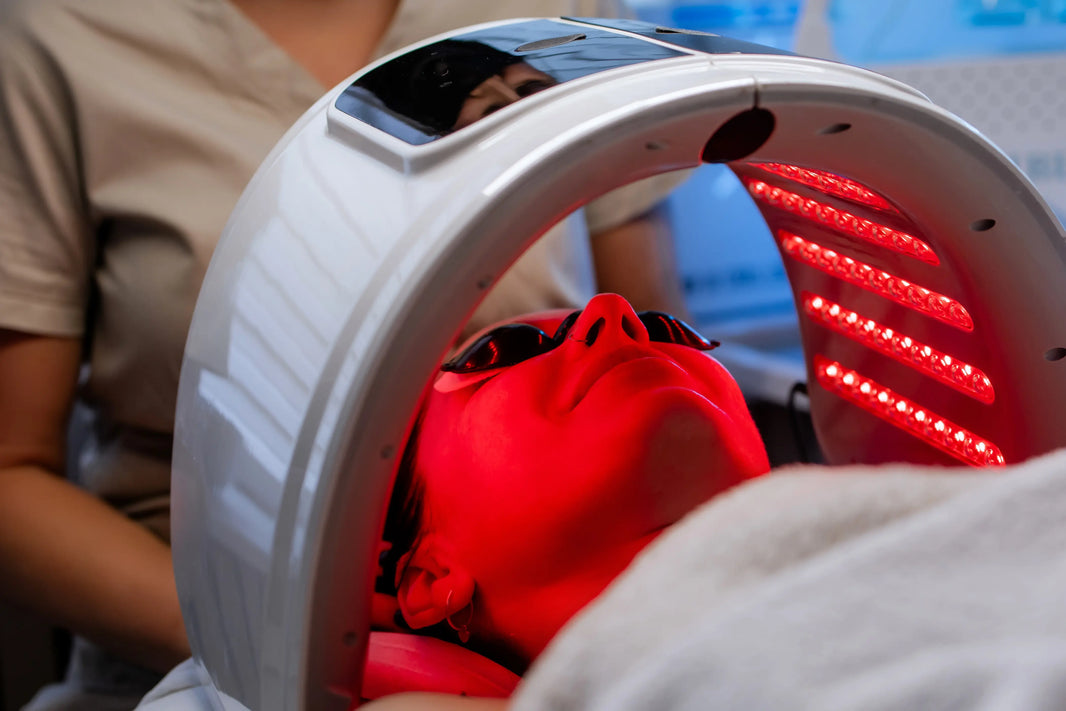 Red Light After Microneedling