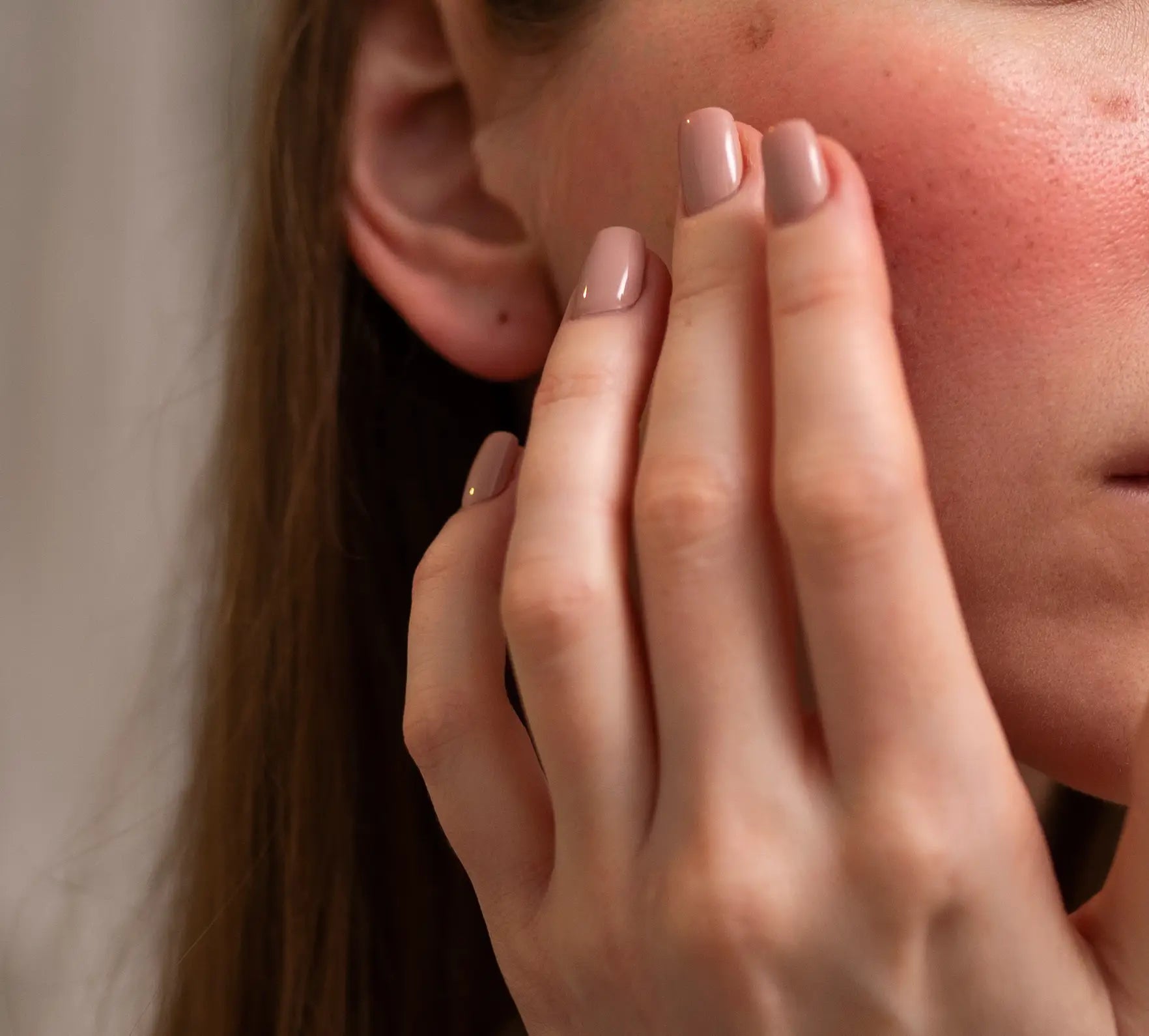 Skin Looks Worse After Chemical Peel