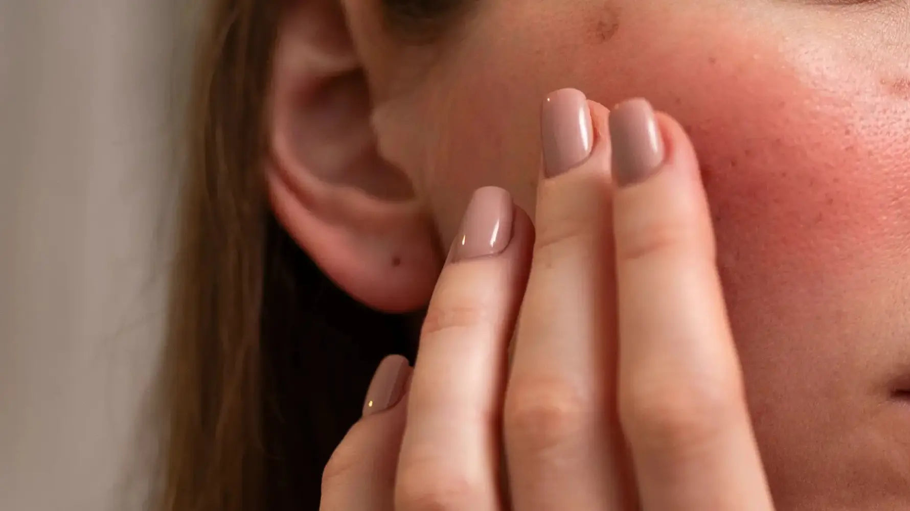 Skin Looks Worse After Chemical Peel