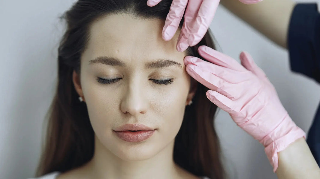 Swelling after microneedling