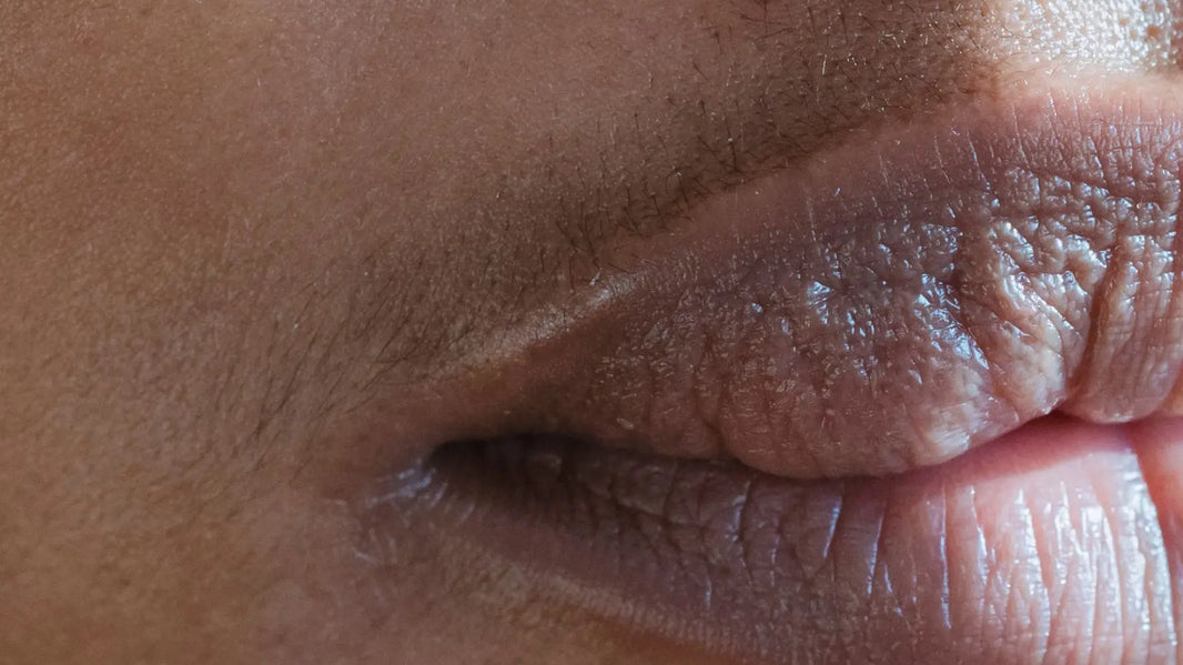 can hyperpigmentation around mouth be cured