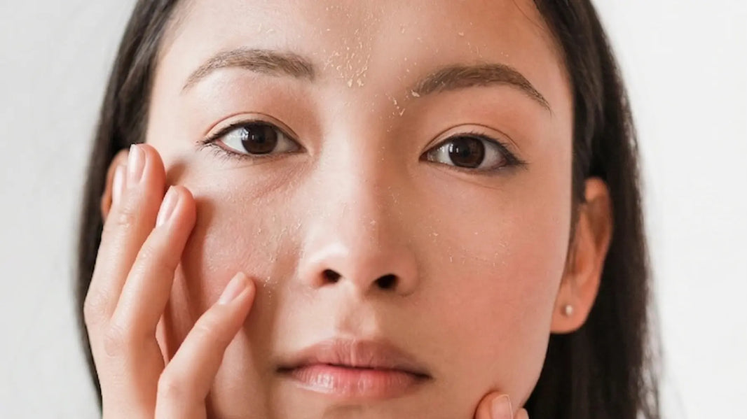 Do You Peel From Microneedling?