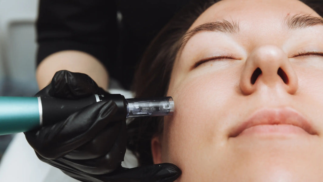 How Often Can I Microneedle My Face?