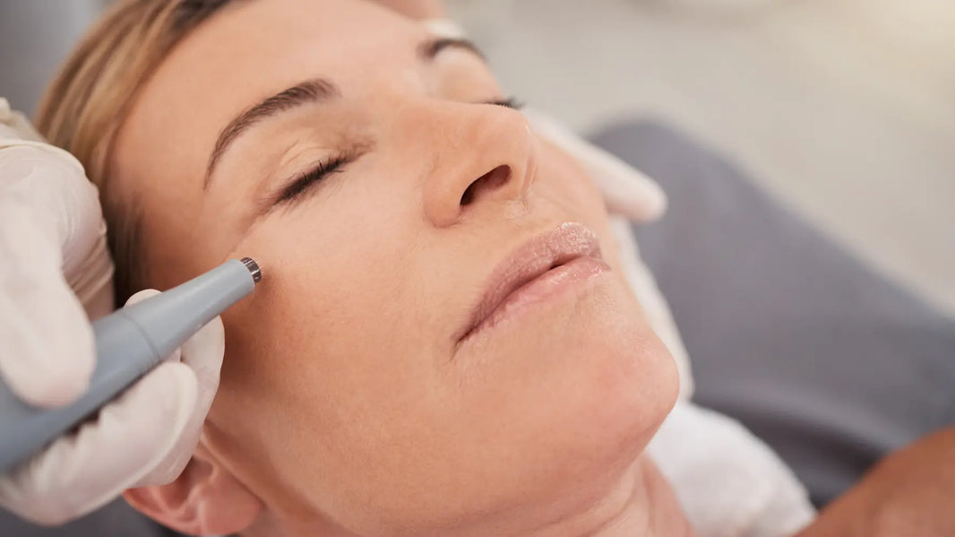 Is Microneedling Safe?
