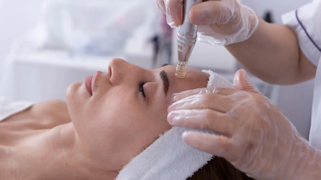What to Do Before Microneedling?