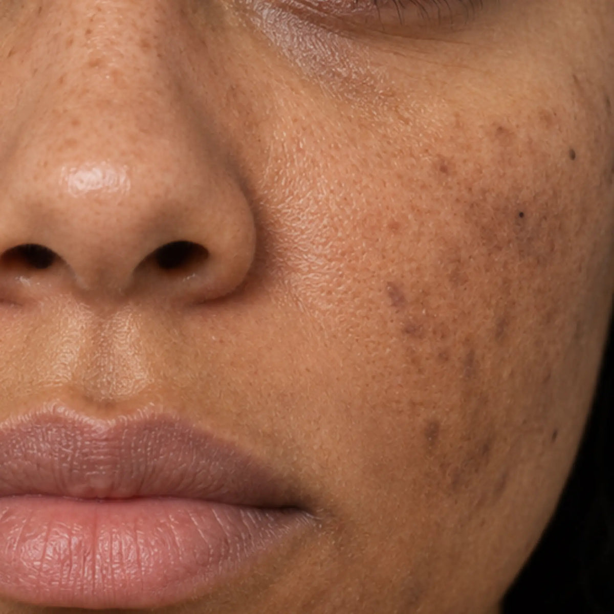 Dark spots