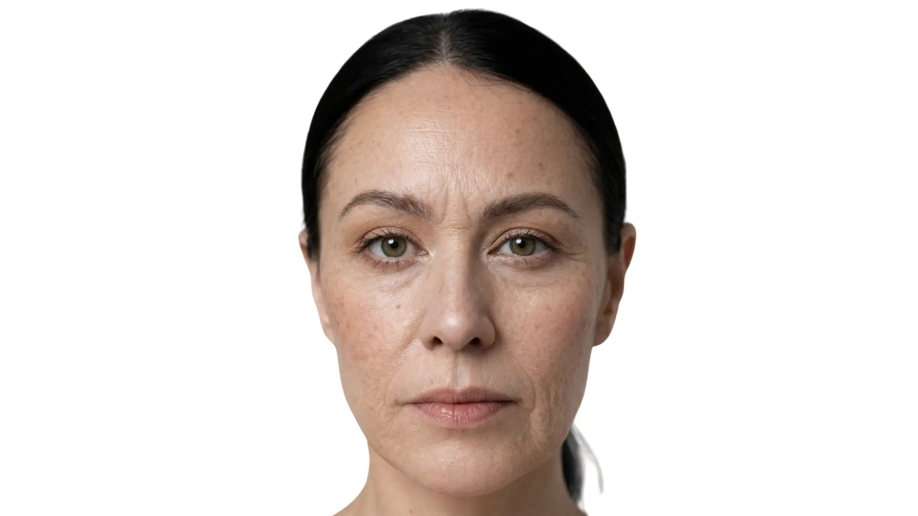 Exosome skincare before