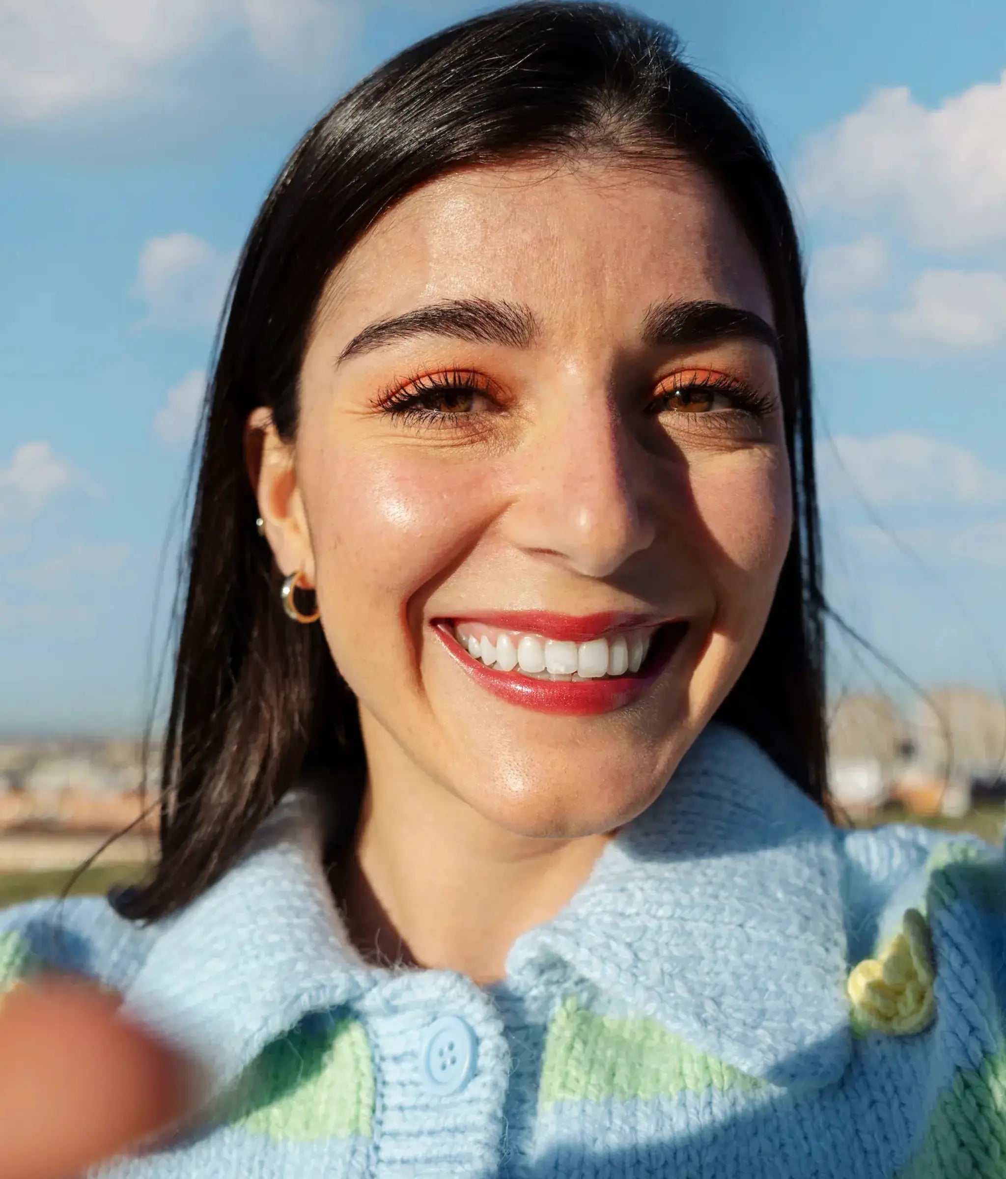 Happy customer after using Exosthetics microneedling serum