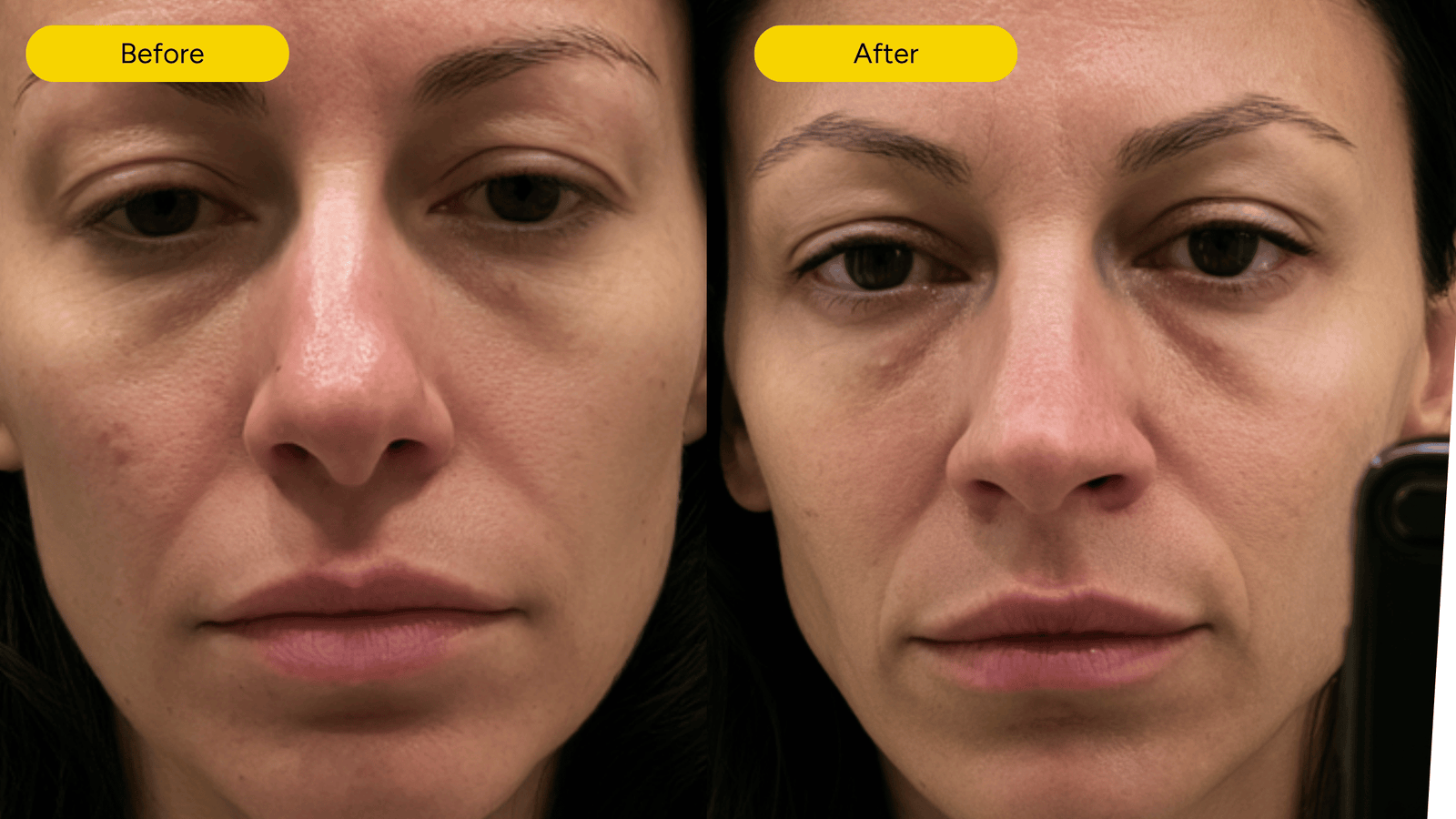 Before and after comparison showing face after consistent use of Exosthetics products