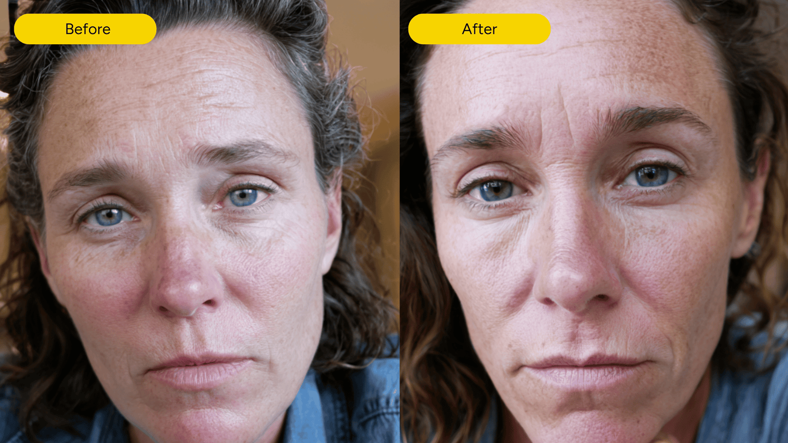 Before and after comparison showing reduced facial redness after consistent use of Exosthetics products