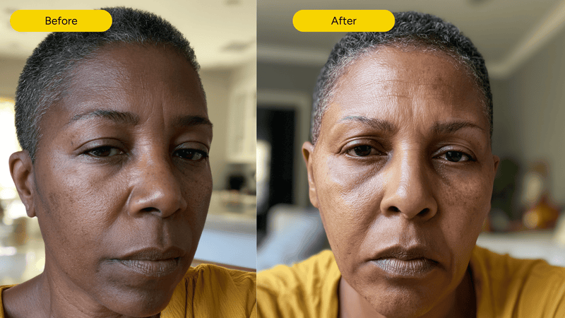 Post procedure recovery before and after with exosome skin serum