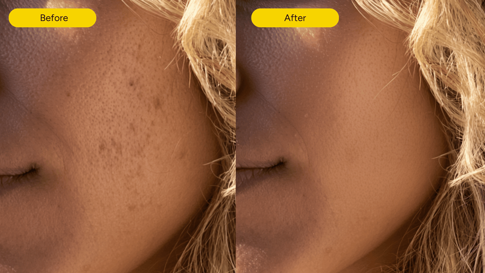 Before and after comparison showing reduced facial spots after consistent use of Exosthetics products