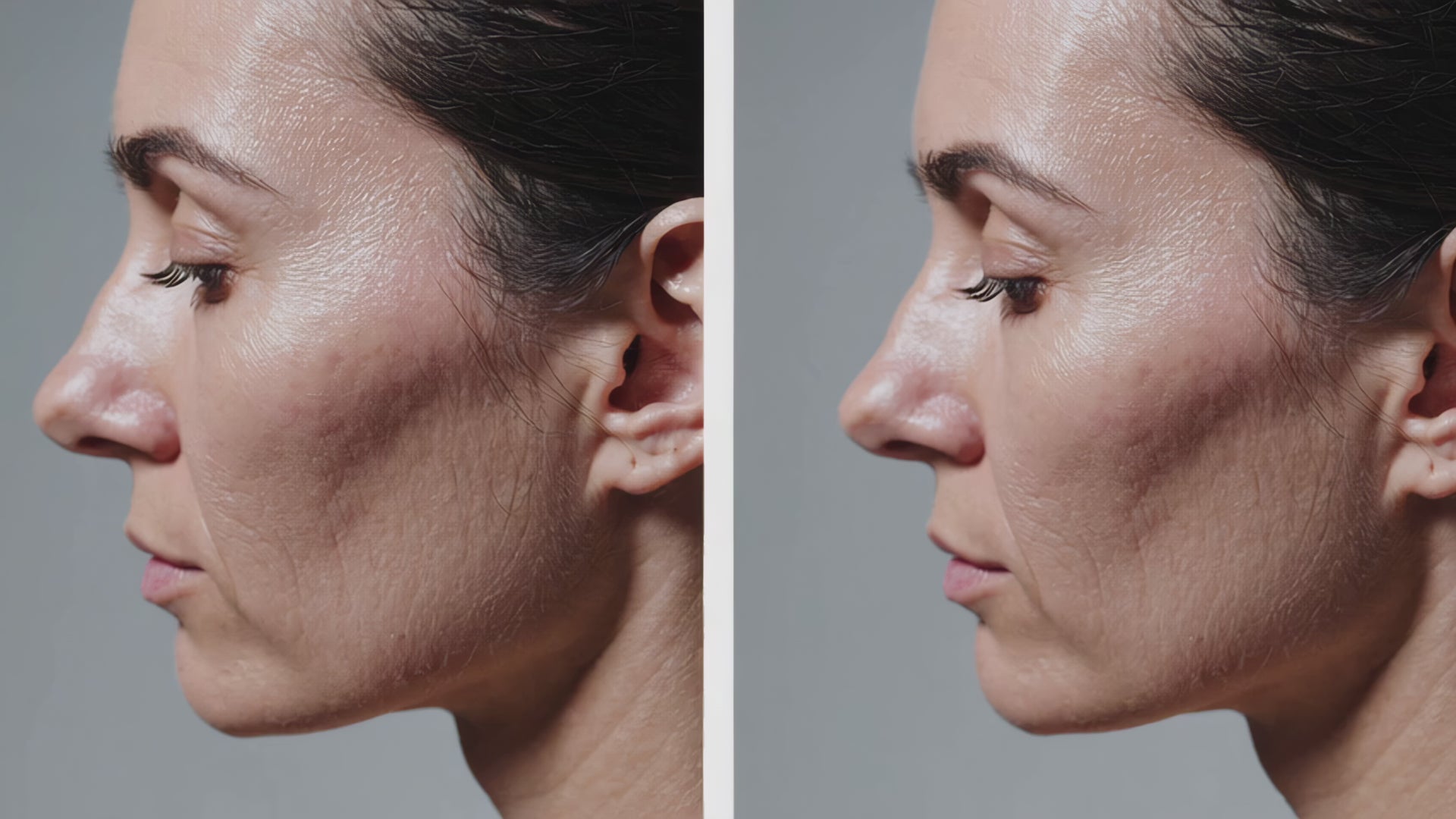 Skin rejuvenation insights