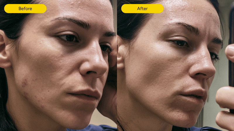 Exosome skincare serum results - before and after skin recovery