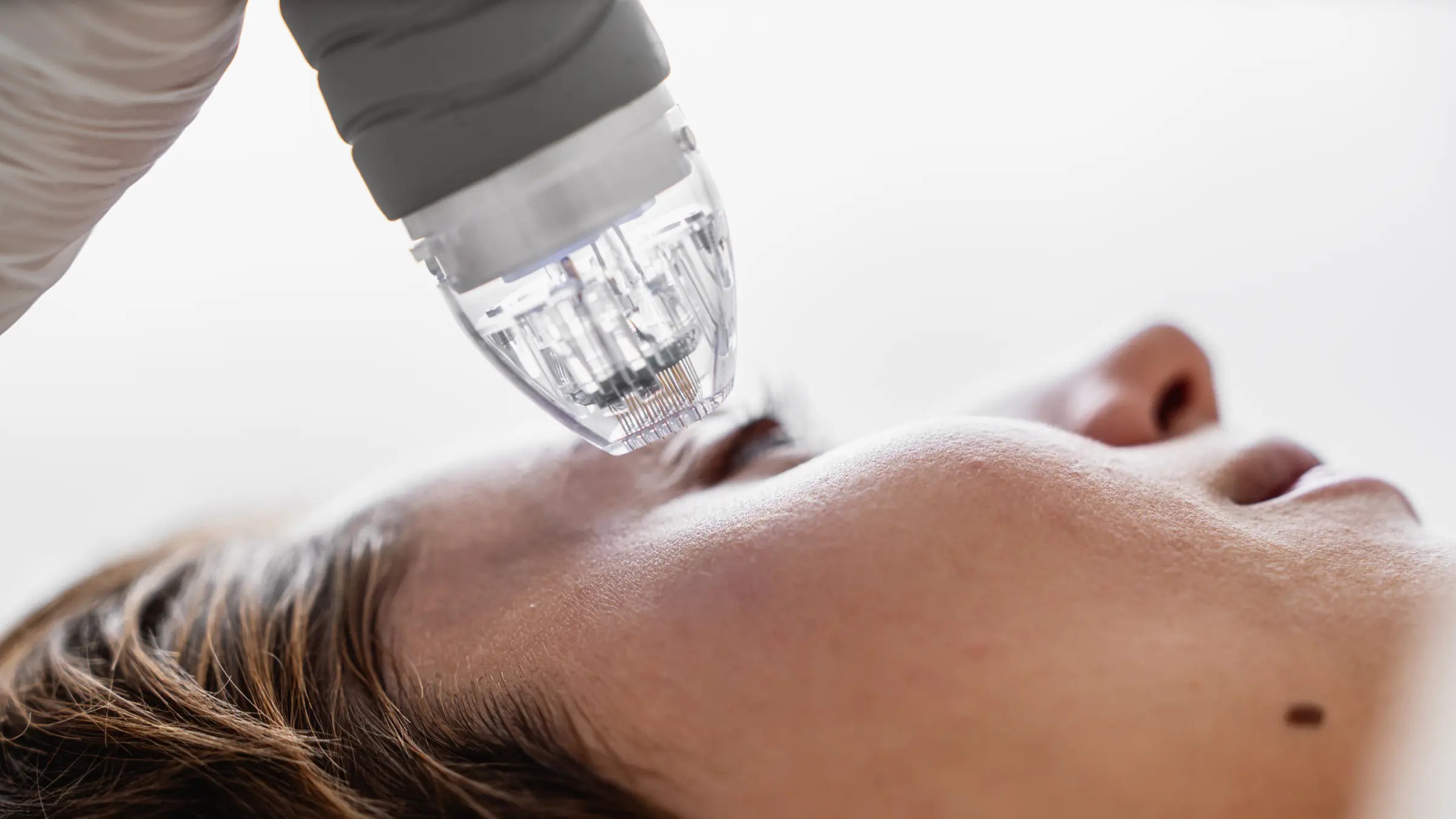 Microneedling aftercare guides